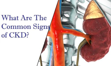 Chronic Kidney Disease