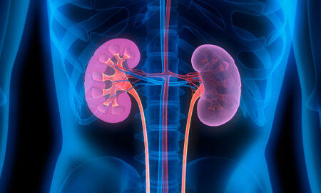 KIDNEY RELOCATE METHOD AND ANALYSIS: CURRENT REALITIES