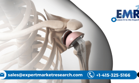 Shoulder Replacement Market