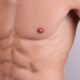 gynecomastia treatment