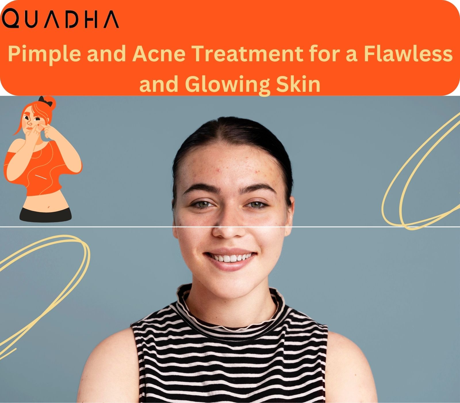 Pimple and Acne Treatment