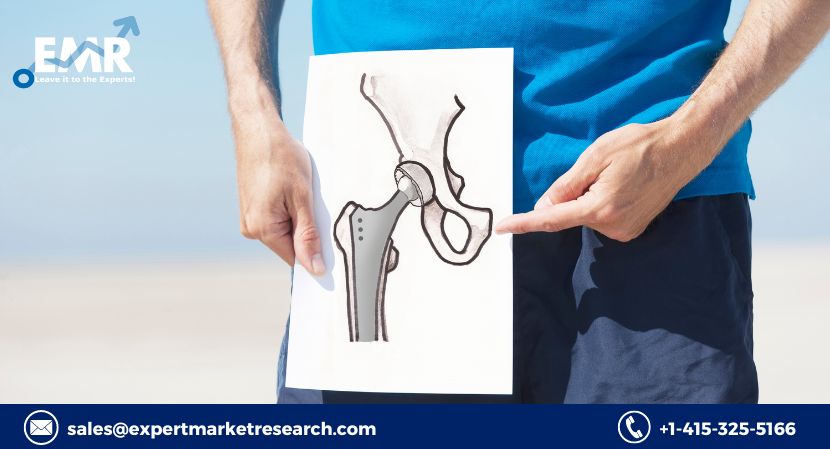 Hip Replacement Implants Market