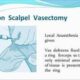 No Scalpel Vasectomy