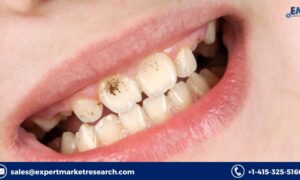 Periodontal Therapeutics Market