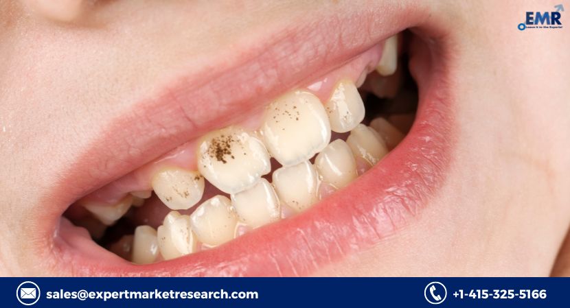 Periodontal Therapeutics Market