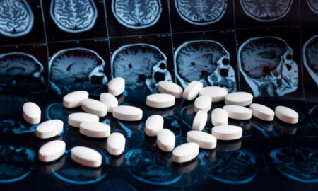 Aniracetam benefits